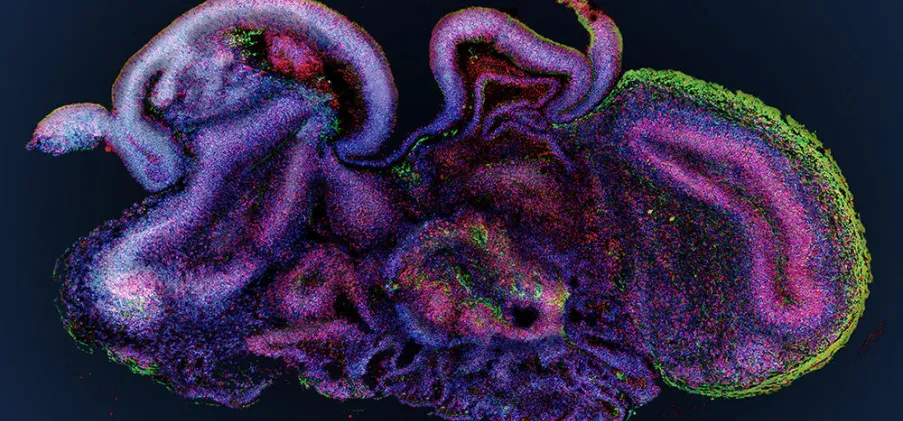 Minibrains : les chercheurs du laboratoire ETIS font avancer la recherche !